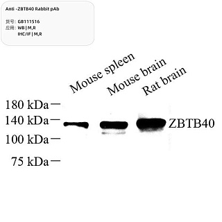 Антитела первичные, поликлональные кролика к ZBTB40 крысы, мыши, 100 мкл